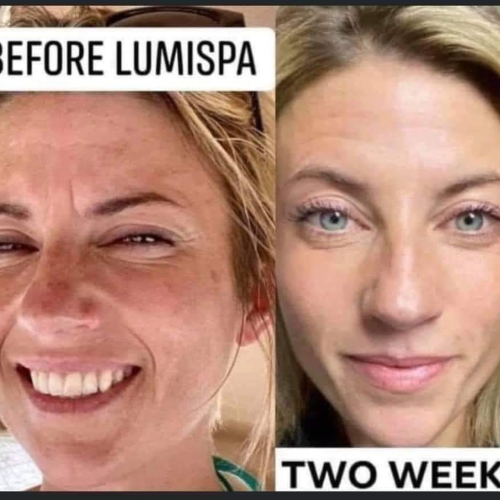 Lumispa - Picture 5 of 6